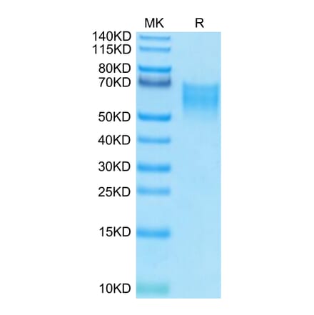 Tris-Bis PAGE - Recombinant Human CD86 Protein (Biotin) (C-terminal His and Avi Tag) (A330414) - Antibodies.com
