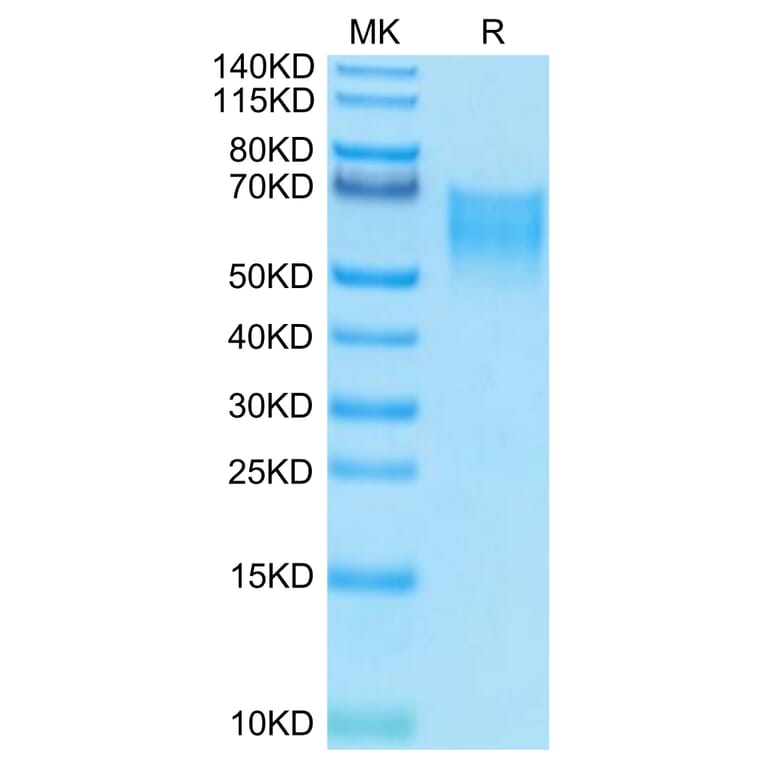 Tris-Bis PAGE - Recombinant Human CD86 Protein (Biotin) (C-terminal His and Avi Tag) (A330414) - Antibodies.com