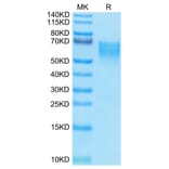 Tris-Bis PAGE - Recombinant Human CD86 Protein (Biotin) (C-terminal His and Avi Tag) (A330414) - Antibodies.com