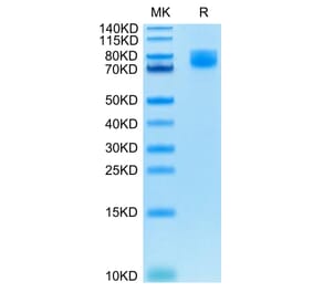 Tris-Bis PAGE - Recombinant Human CD86 Protein (C-terminal Human Fc Tag) (A330415) - Antibodies.com