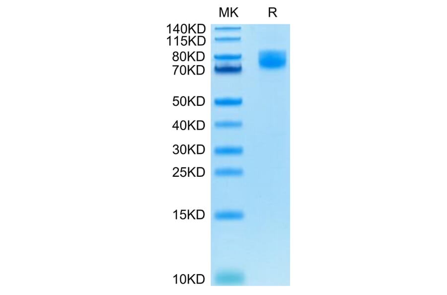 Tris-Bis PAGE - Recombinant Human CD86 Protein (C-terminal Human Fc Tag) (A330415) - Antibodies.com