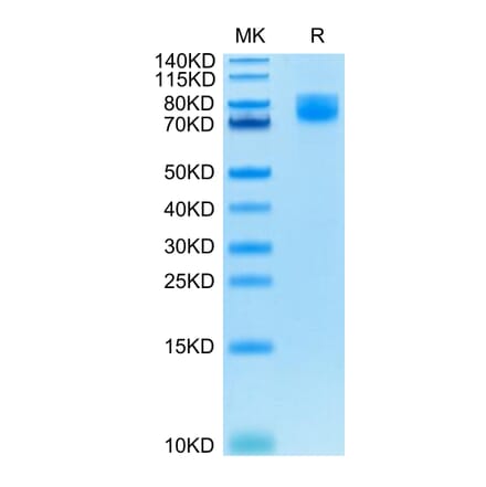 Tris-Bis PAGE - Recombinant Human CD86 Protein (C-terminal Human Fc Tag) (A330415) - Antibodies.com