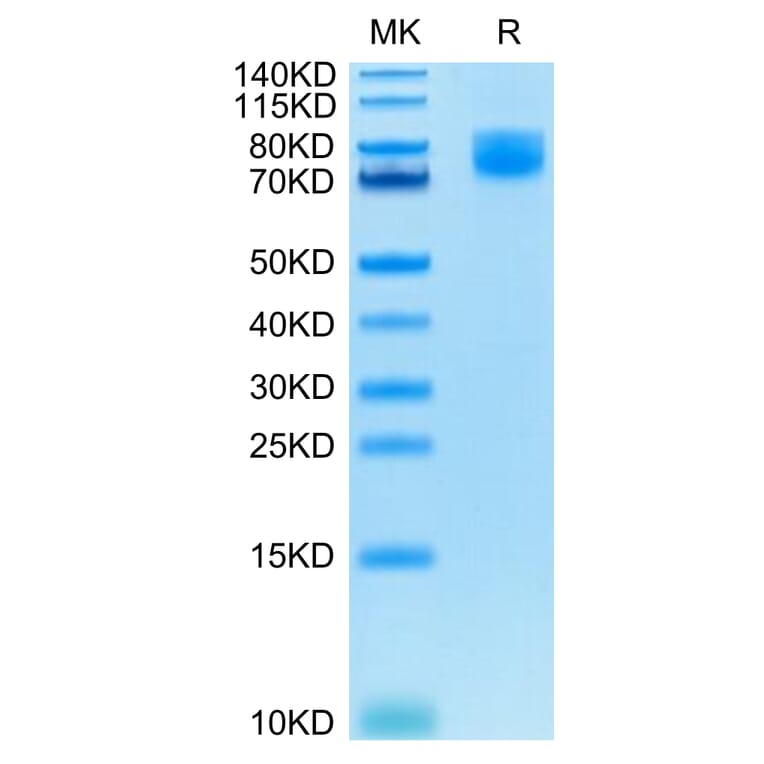 Tris-Bis PAGE - Recombinant Human CD86 Protein (C-terminal Human Fc Tag) (A330415) - Antibodies.com