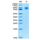 Tris-Bis PAGE - Recombinant Human CD86 Protein (C-terminal Human Fc Tag) (A330415) - Antibodies.com