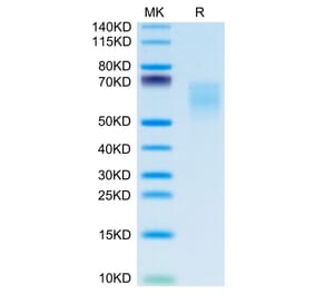 Tris-Bis PAGE - Recombinant Human CD86 Protein (C-terminal His and Avi Tag) (A330416) - Antibodies.com