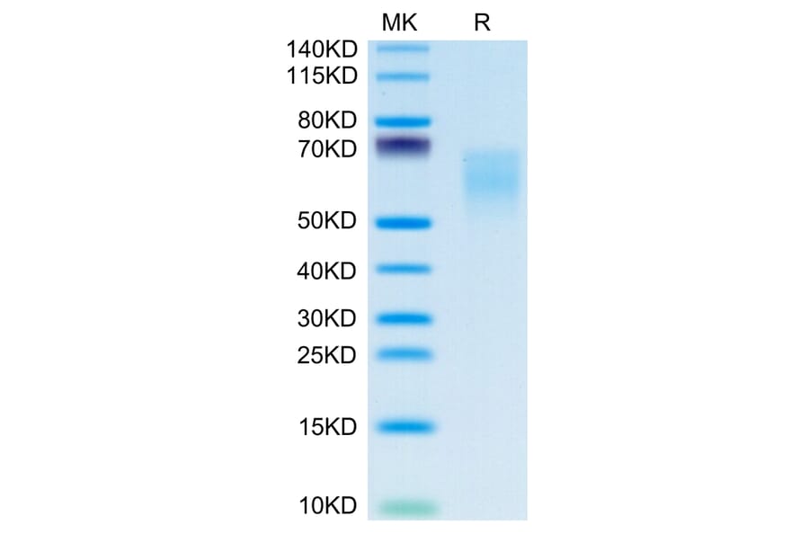 Tris-Bis PAGE - Recombinant Human CD86 Protein (C-terminal His and Avi Tag) (A330416) - Antibodies.com