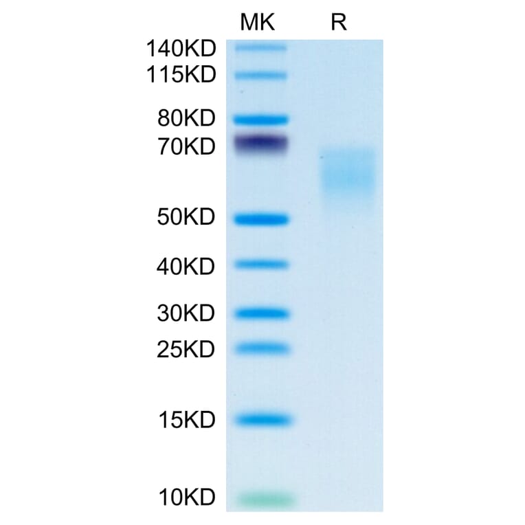 Tris-Bis PAGE - Recombinant Human CD86 Protein (C-terminal His and Avi Tag) (A330416) - Antibodies.com