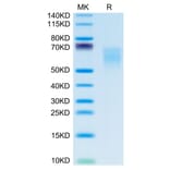 Tris-Bis PAGE - Recombinant Human CD86 Protein (C-terminal His and Avi Tag) (A330416) - Antibodies.com