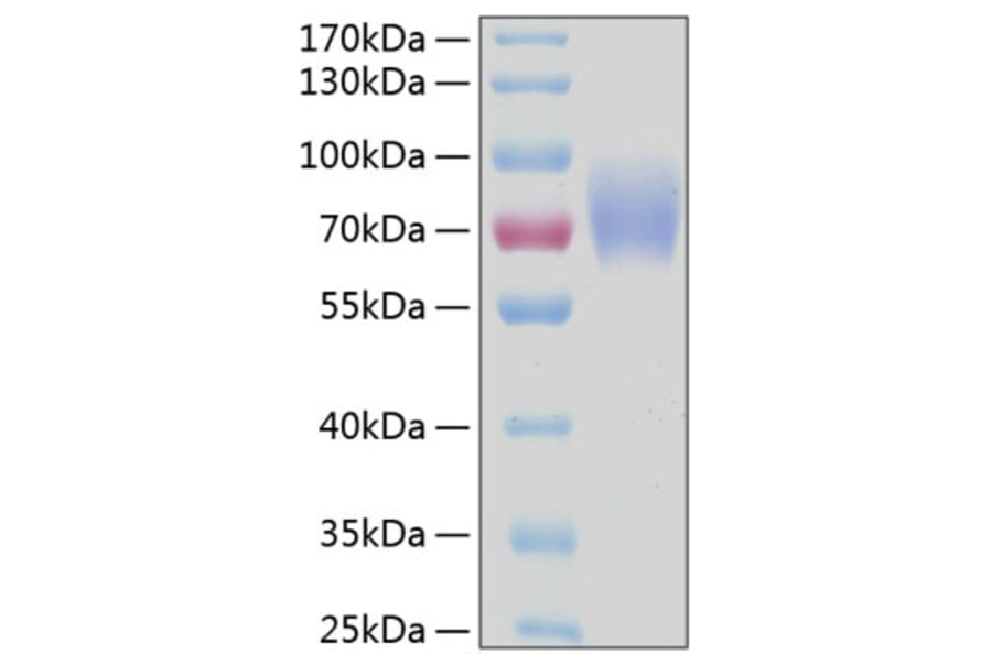 SDS-PAGE - Recombinant Human CD89 Protein (C-terminal Human Fc and His Tag) (A330417) - Antibodies.com