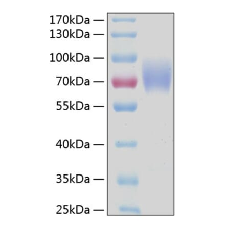 SDS-PAGE - Recombinant Human CD89 Protein (C-terminal Human Fc and His Tag) (A330417) - Antibodies.com