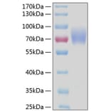 SDS-PAGE - Recombinant Human CD89 Protein (C-terminal Human Fc and His Tag) (A330417) - Antibodies.com