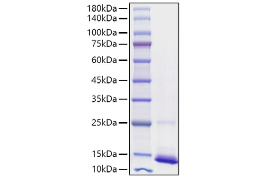 SDS-PAGE - Recombinant human CD9 Protein (C-terminal His Tag) (A330418) - Antibodies.com