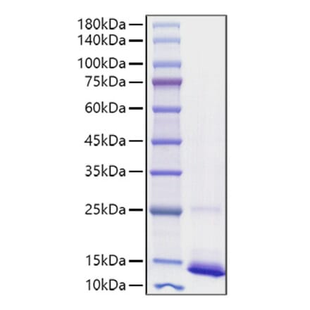 SDS-PAGE - Recombinant human CD9 Protein (C-terminal His Tag) (A330418) - Antibodies.com