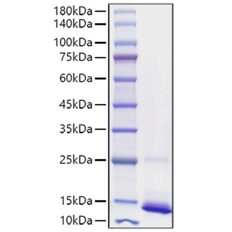 SDS-PAGE - Recombinant human CD9 Protein (C-terminal His Tag) (A330418) - Antibodies.com