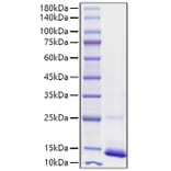 SDS-PAGE - Recombinant human CD9 Protein (C-terminal His Tag) (A330418) - Antibodies.com