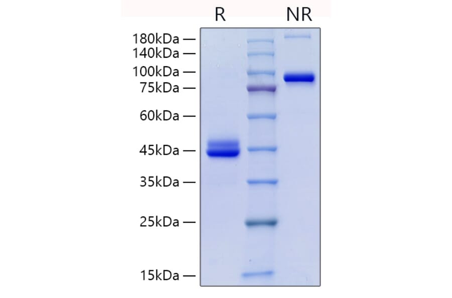 SDS-PAGE - Recombinant Human CD9 Protein (C-terminal Human Fc Tag) (A330419) - Antibodies.com