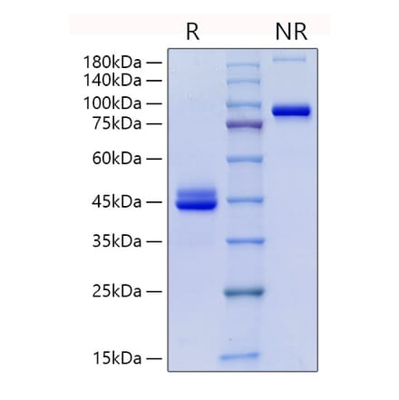 SDS-PAGE - Recombinant Human CD9 Protein (C-terminal Human Fc Tag) (A330419) - Antibodies.com