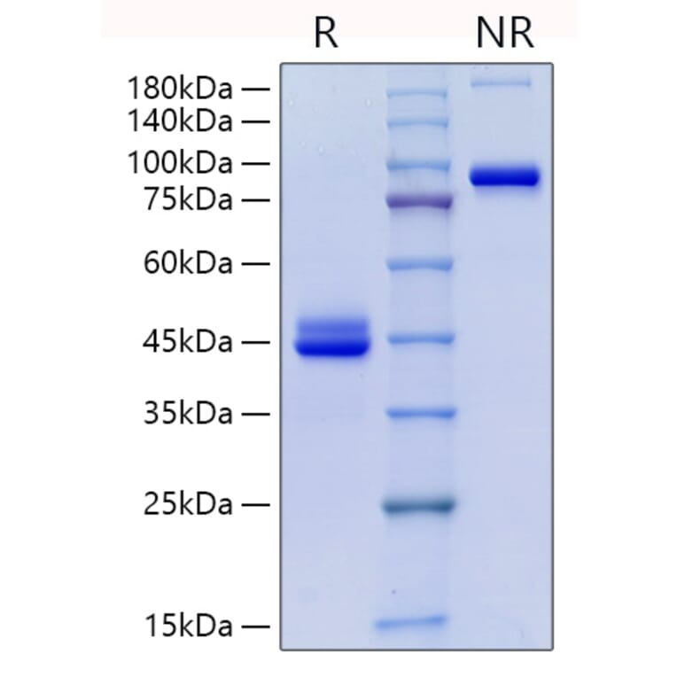 SDS-PAGE - Recombinant Human CD9 Protein (C-terminal Human Fc Tag) (A330419) - Antibodies.com