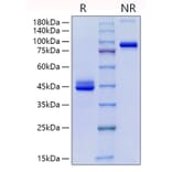 SDS-PAGE - Recombinant Human CD9 Protein (C-terminal Human Fc Tag) (A330419) - Antibodies.com