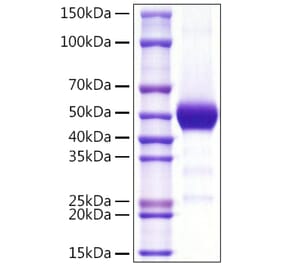 SDS-PAGE - Recombinant Human CD90 Protein (C-terminal Rabbit Fc Tag) (A330420) - Antibodies.com
