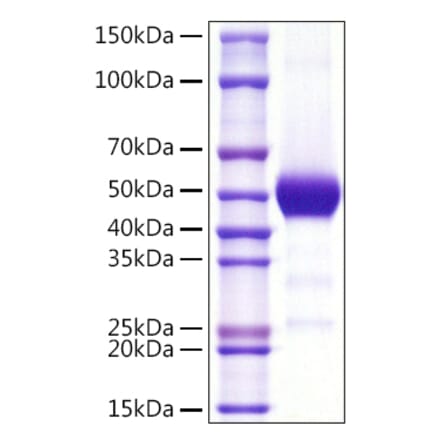 SDS-PAGE - Recombinant Human CD90 Protein (C-terminal Rabbit Fc Tag) (A330420) - Antibodies.com