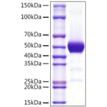 SDS-PAGE - Recombinant Human CD90 Protein (C-terminal Rabbit Fc Tag) (A330420) - Antibodies.com