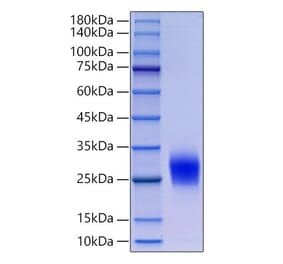 SDS-PAGE - Recombinant Human CD90 Protein (N-terminal His Tag) (A330421) - Antibodies.com