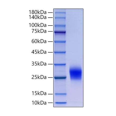 SDS-PAGE - Recombinant Human CD90 Protein (N-terminal His Tag) (A330421) - Antibodies.com