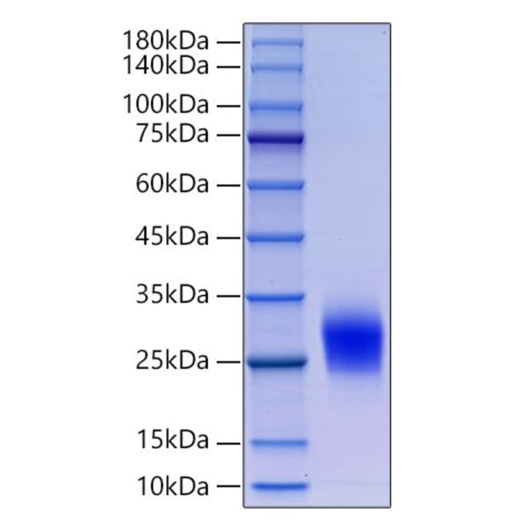 SDS-PAGE - Recombinant Human CD90 Protein (N-terminal His Tag) (A330421) - Antibodies.com
