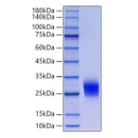 SDS-PAGE - Recombinant Human CD90 Protein (N-terminal His Tag) (A330421) - Antibodies.com