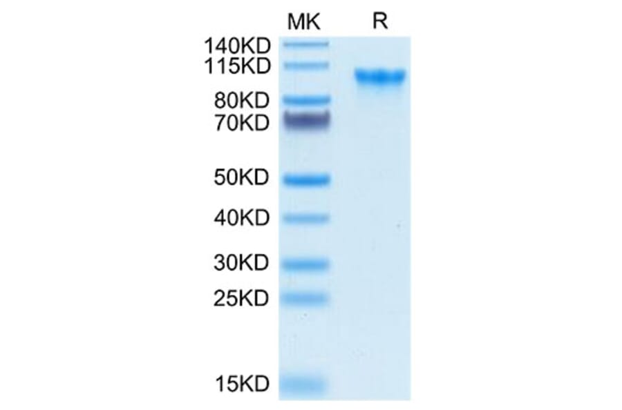 Tris-Bis PAGE - Recombinant Human CD93 Protein (Biotin) (C-terminal His and Avi Tag) (A330422) - Antibodies.com