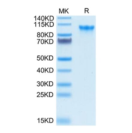 Tris-Bis PAGE - Recombinant Human CD93 Protein (Biotin) (C-terminal His and Avi Tag) (A330422) - Antibodies.com