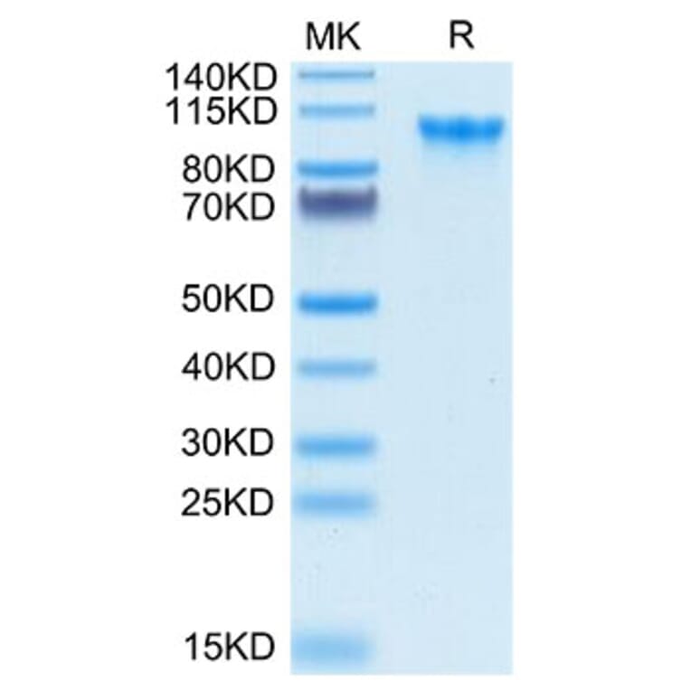 Tris-Bis PAGE - Recombinant Human CD93 Protein (Biotin) (C-terminal His and Avi Tag) (A330422) - Antibodies.com