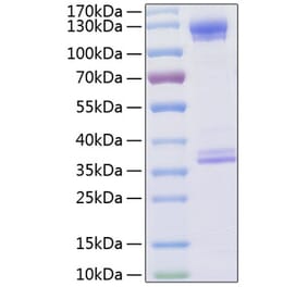 SDS-PAGE - Recombinant Human CD93 Protein (C-terminal Human Fc and His Tag) (A330423) - Antibodies.com