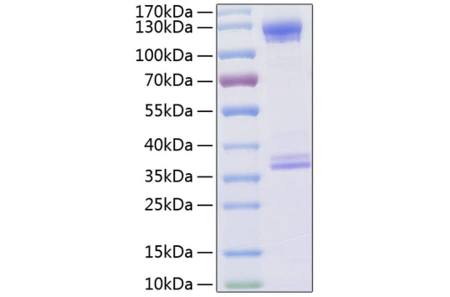 SDS-PAGE - Recombinant Human CD93 Protein (C-terminal Human Fc and His Tag) (A330423) - Antibodies.com