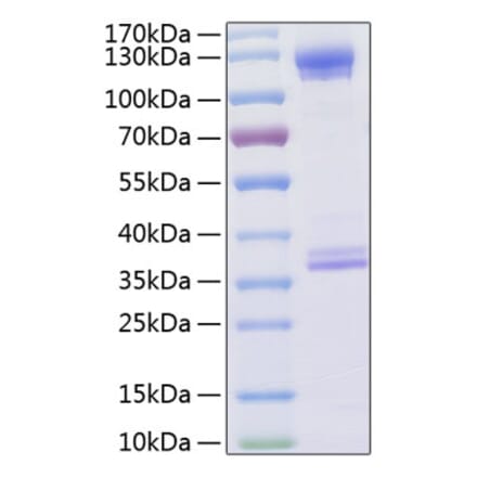 SDS-PAGE - Recombinant Human CD93 Protein (C-terminal Human Fc and His Tag) (A330423) - Antibodies.com