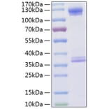 SDS-PAGE - Recombinant Human CD93 Protein (C-terminal Human Fc and His Tag) (A330423) - Antibodies.com