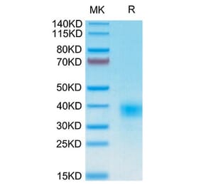 Tris-Bis PAGE - Recombinant Human CD94 Protein (N-terminal His and Avi Tag) (A330424) - Antibodies.com