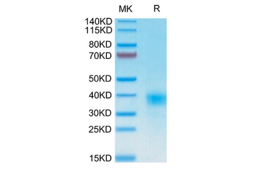 Tris-Bis PAGE - Recombinant Human CD94 Protein (N-terminal His and Avi Tag) (A330424) - Antibodies.com