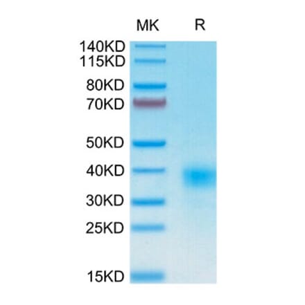 Tris-Bis PAGE - Recombinant Human CD94 Protein (N-terminal His and Avi Tag) (A330424) - Antibodies.com