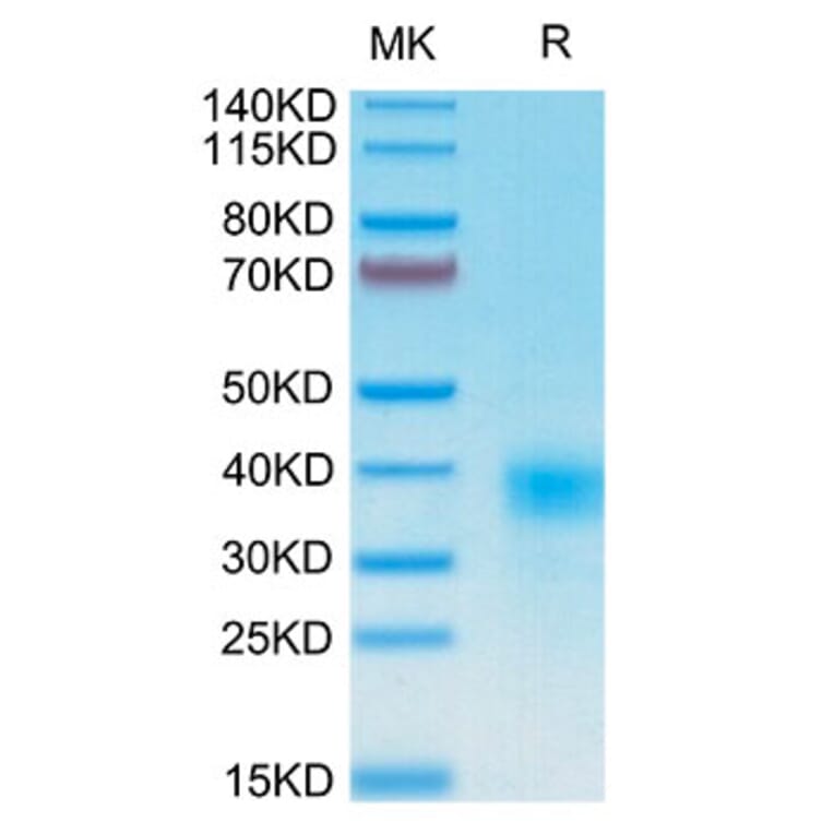 Tris-Bis PAGE - Recombinant Human CD94 Protein (N-terminal His and Avi Tag) (A330424) - Antibodies.com