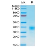 Tris-Bis PAGE - Recombinant Human CD94 Protein (N-terminal His and Avi Tag) (A330424) - Antibodies.com