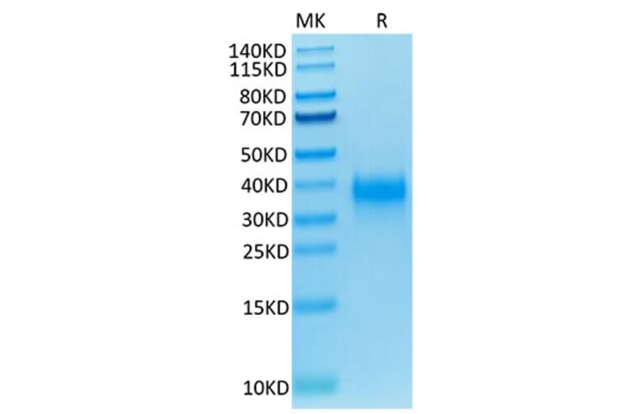 Tris-Bis PAGE - Recombinant Human CD94 Protein (Biotin) (N-terminal His and Avi Tag) (A330425) - Antibodies.com