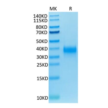 Tris-Bis PAGE - Recombinant Human CD94 Protein (Biotin) (N-terminal His and Avi Tag) (A330425) - Antibodies.com