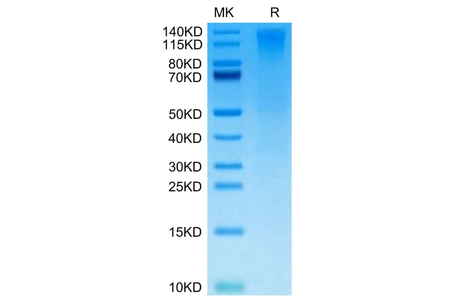 Tris-Bis PAGE - Recombinant Human CD96 Protein (Biotin) (C-terminal His and Avi Tag) (A330426) - Antibodies.com