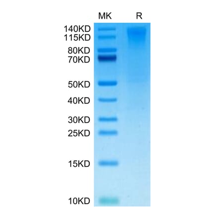 Tris-Bis PAGE - Recombinant Human CD96 Protein (Biotin) (C-terminal His and Avi Tag) (A330426) - Antibodies.com