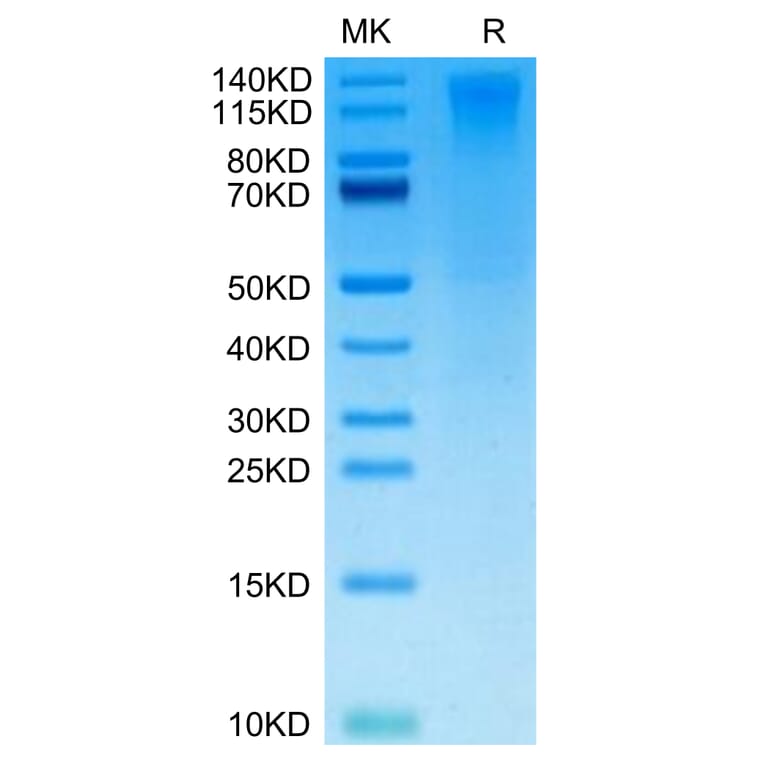 Tris-Bis PAGE - Recombinant Human CD96 Protein (Biotin) (C-terminal His and Avi Tag) (A330426) - Antibodies.com