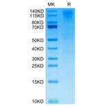 Tris-Bis PAGE - Recombinant Human CD96 Protein (Biotin) (C-terminal His and Avi Tag) (A330426) - Antibodies.com