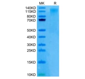 Tris-Bis PAGE - Recombinant Human CD96 Protein (C-terminal His Tag) (A330427) - Antibodies.com