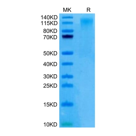 Tris-Bis PAGE - Recombinant Human CD96 Protein (C-terminal His Tag) (A330427) - Antibodies.com